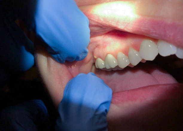 Best Weekend Emergency Dental Services in Jacksonvle, IL